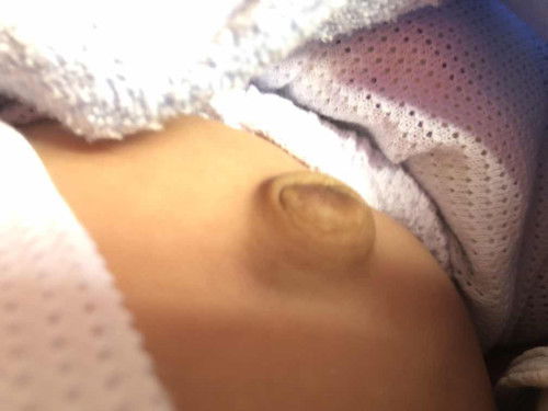 Pusat baby terkeluar