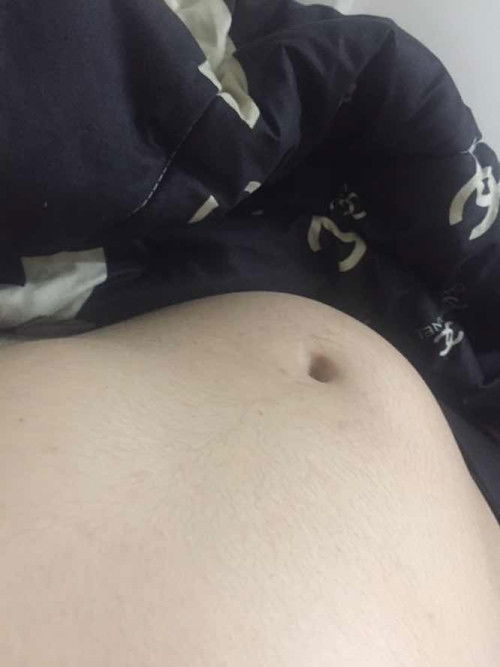 ท้อง19วีค เป็นก้อน