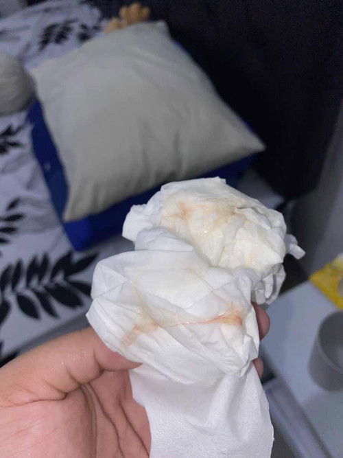 Keluar lendir disertai flek