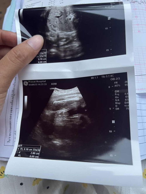 ผู้ชายไหมค่ะแม่ๆช่วยดูหน่อยค่ะ ใจอยากได้ลูกสาวมากๆค่ะ