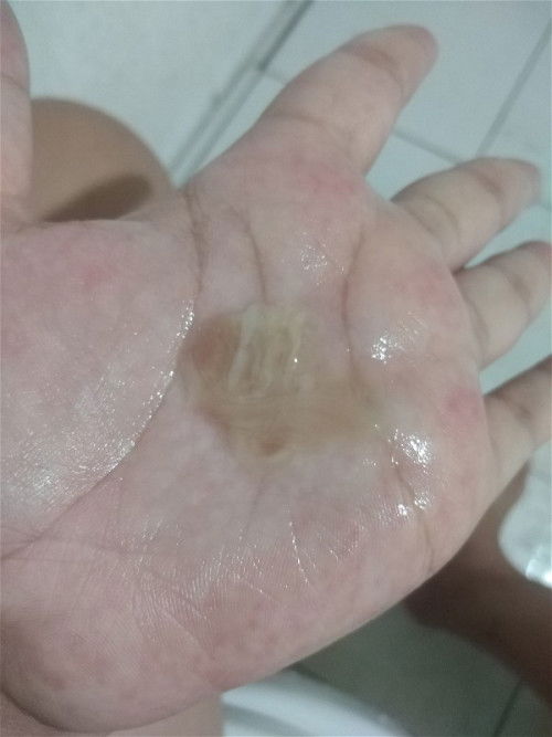 อันนี้คือมูกจะคลอดรึป่าว