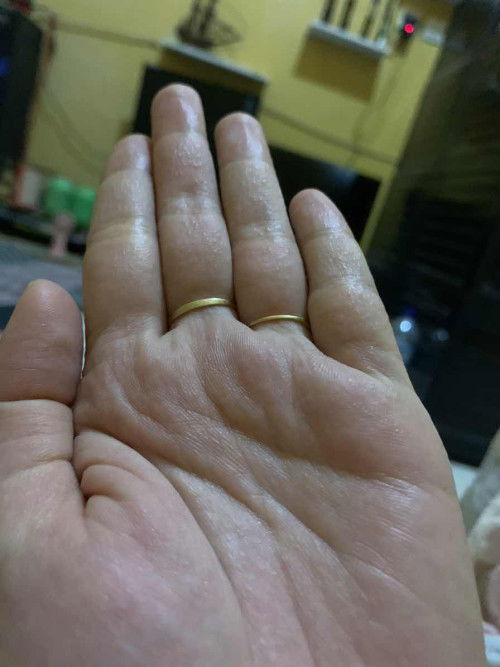 Gatal gatal di tangan dan kaki