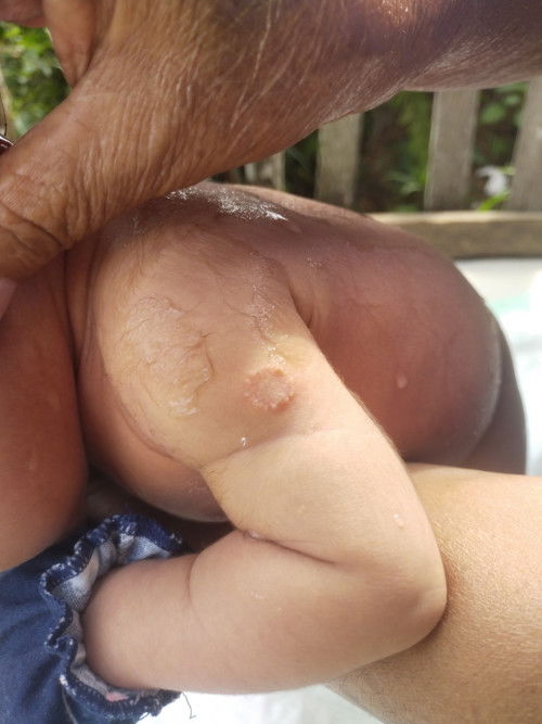 Obatnya apa ya Bun??