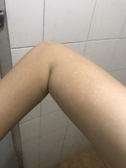 เกิดจากอะไรคะแบบนี้