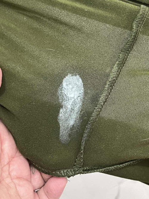 White discharge 37w2d