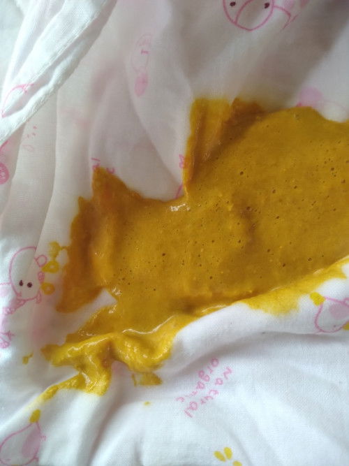 เเบบนี้ใช่ท้องเสียป่าวคะเเต่น้องพึ่งถ่ายครั้งเเรกค่ะ