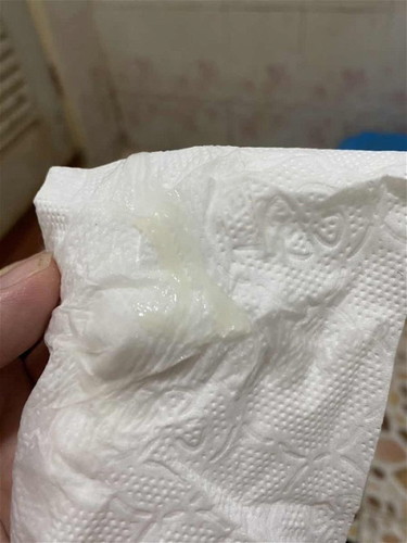 ท้อง37+5 มีมูกใสๆออกแบบนี้ปกติมั้ยค่ะ
