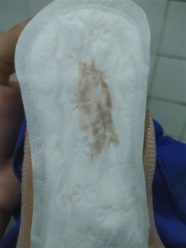 Mucus plug na ba ito?