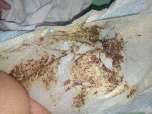 Pasintabi po sa picture.