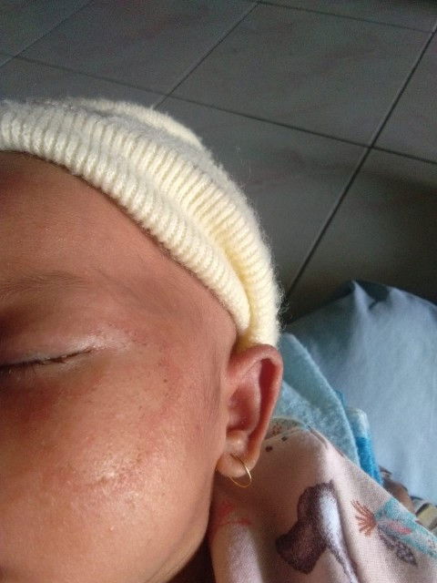 Pipi merah dan putih seperti buras kenapa ya bun?tolong kalau ada yng tau