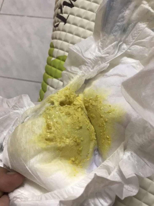 Bayi terus berak selepas menyusu