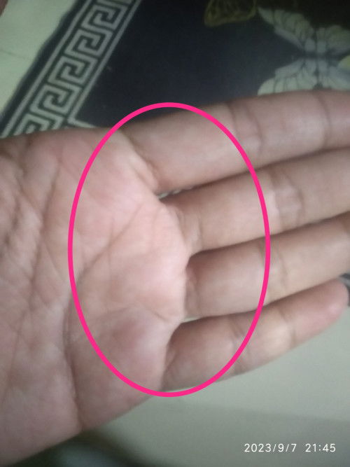 Mommies, tiap mlm sakit xblh bengkok dkt yg bertanda...normal ke?  Baru beberapa mggu...37weeks