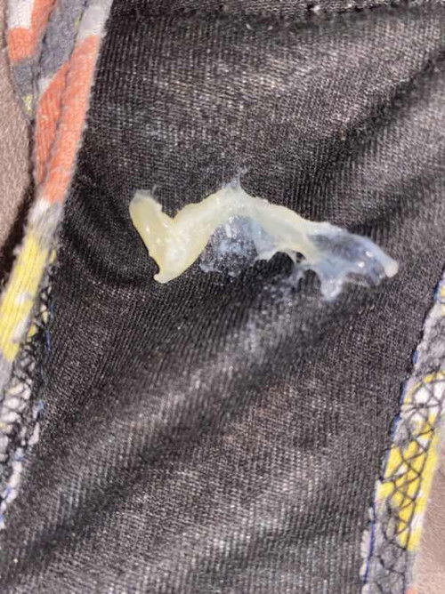 Mucus plug na po ba ito?