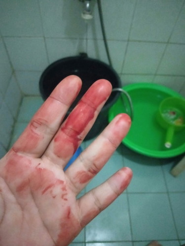 ไปกระตุ้นมาวันที่5/9