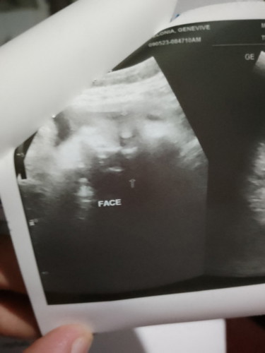 38weeks4days