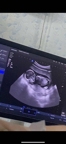 เด็กนอนคว่ำ🥺🥺🥺