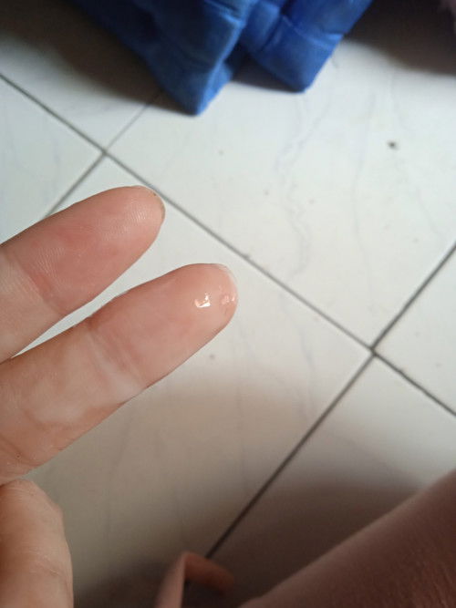 Bun mf klo jorok.. Kira2 ini keputihan.. Ataw apa yh