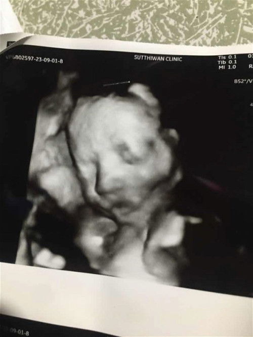 แม่ๆ29วีคโชว์หน้ารูปน้องหน่อยค่ะ