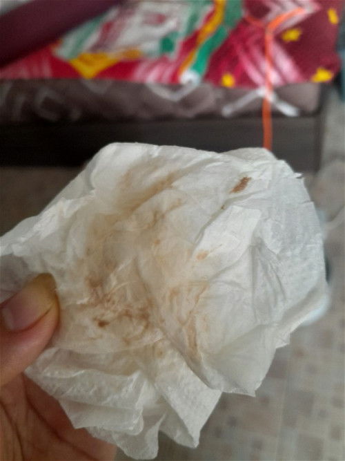 เมื่อวานโดนกระตุ้น ปากมดลูกเปิด 1 เซน  วันนี้มีมูกสีน้ำตาลปกติไหมค่ะ ปวดท้องแต่ไม่ถี่