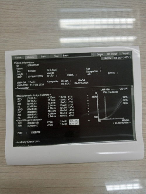 ในนี้เขาได้บอกเพศลูกมั้ยคะ