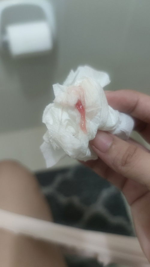 Mucus plug with blood
