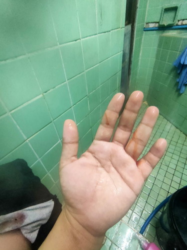 วันนี้ไปหาหมอมา 38+2 วีค หมอกระตุ้นปากมดลูก มีมูกเลือดออกมา ปวดท้องหน่วงๆ