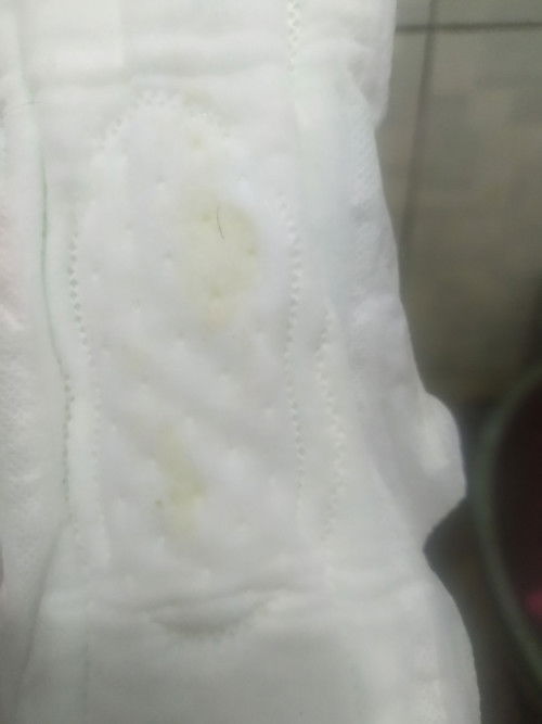 Air Ketuban atau Keputihan?