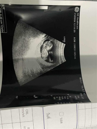 ขอดูภาพอัลตราซาวด์ของแม่ๆหน่อยค่ะ