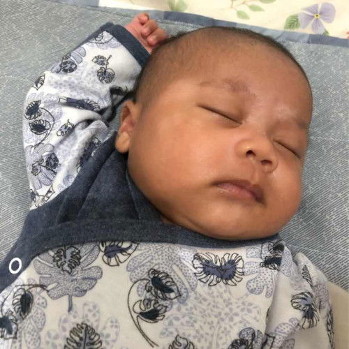 Putih putih di wajah bayi