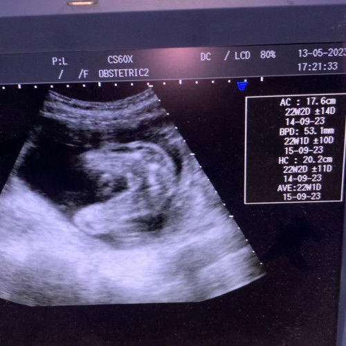 หญิงหรือชายค่ะ