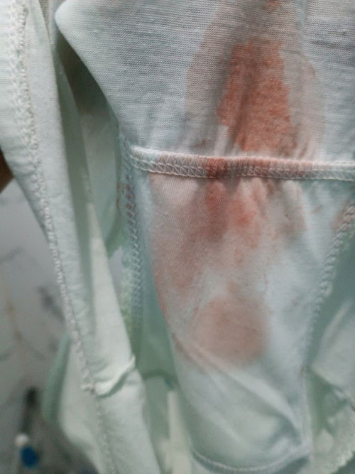 Apakah spt ini tanda persalinan? Atau bahaya ya bund?