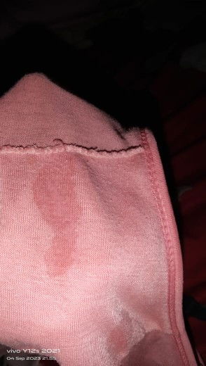 Keputihan apa ketuban