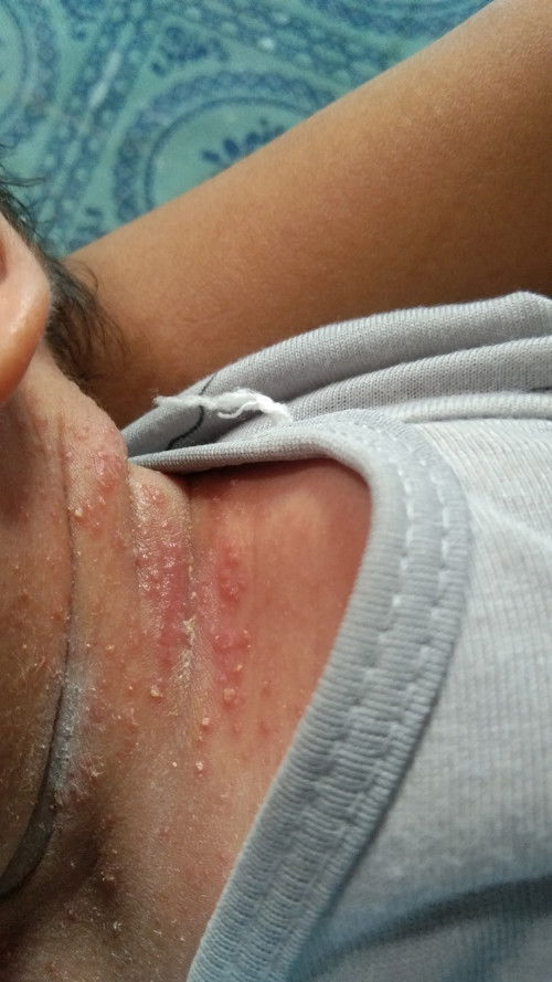 Bunda2 mohon dikasih solusi buat bayiku 🥲