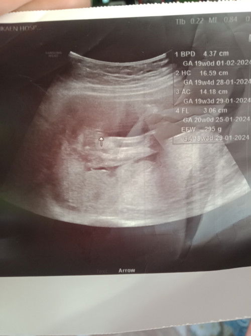 ผู้ชายหรือผู้หญิงคะ