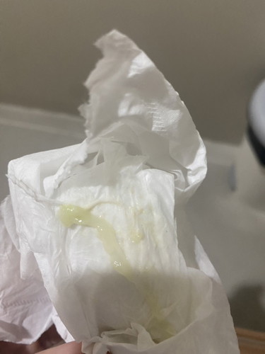 สอบถามแม่ๆค่ะท้องได้35+5week มีตกขาวสีแบบนี้ จะเป็นไรมั้ยคะ