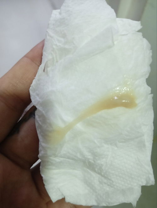 Mucus plug na po ba eto? Last IE kasi nung Thursday closed cervix pako.
