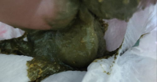 Feses Bayi warna hijau tua