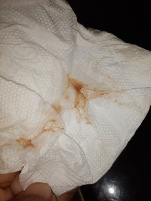 ท้อง2ยังกังวล