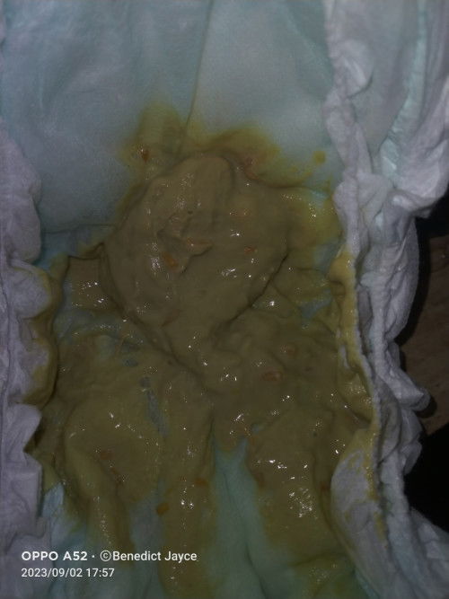 May diarrhea ang 15 months old baby ko