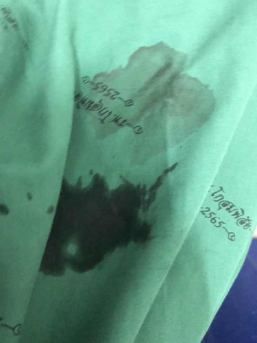 ทัอง38+4หมอบอกปากมดลูกเปิดแล้วแต่ผ่านมาสิงสันยังไม่คลอด