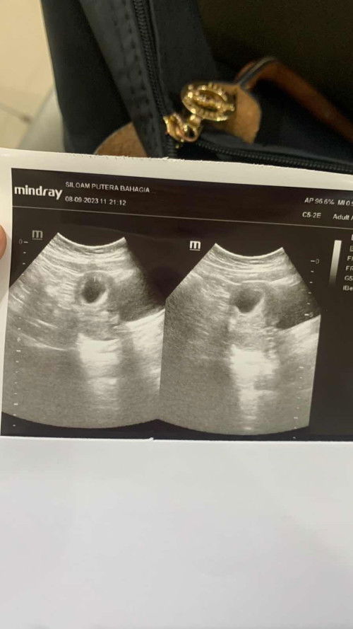 7w janin belum terlihat