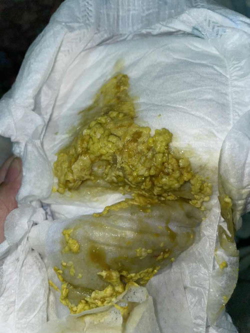 najis baby berketul2