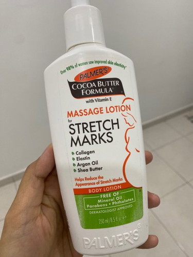 Losyen stretch mark