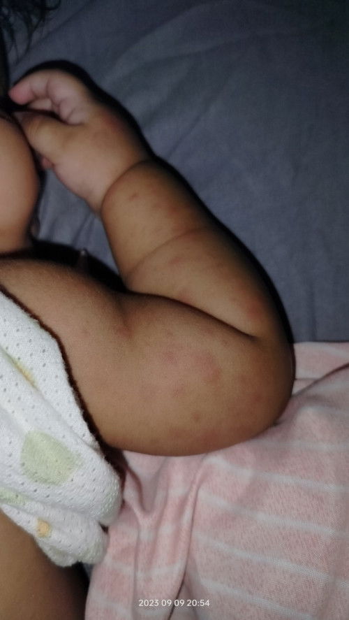 #MapupulaSaBalat NiBaby