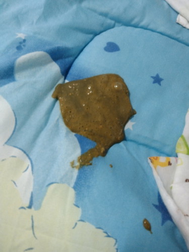 น้องกินนมตราหมี ถ่ายไม่บ่อย