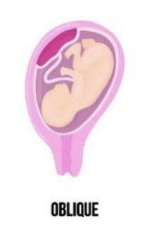 Posisi bayi dibawah tapi posisi oblique