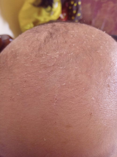 Hallo bun ada yg pernah ngalamin anaknya begini bagi tipsnya buat ilangin bun