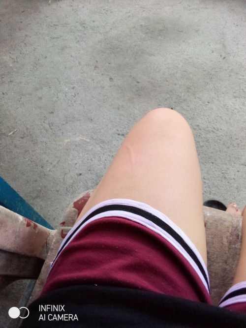 Nakalmot po ako NG pusa . Pero alaga Naman po un  di naman po dumugo at di malalim.