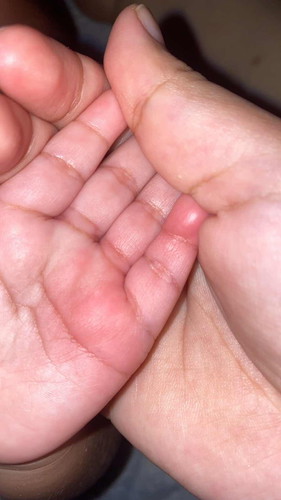 Melecur kne bubur panas