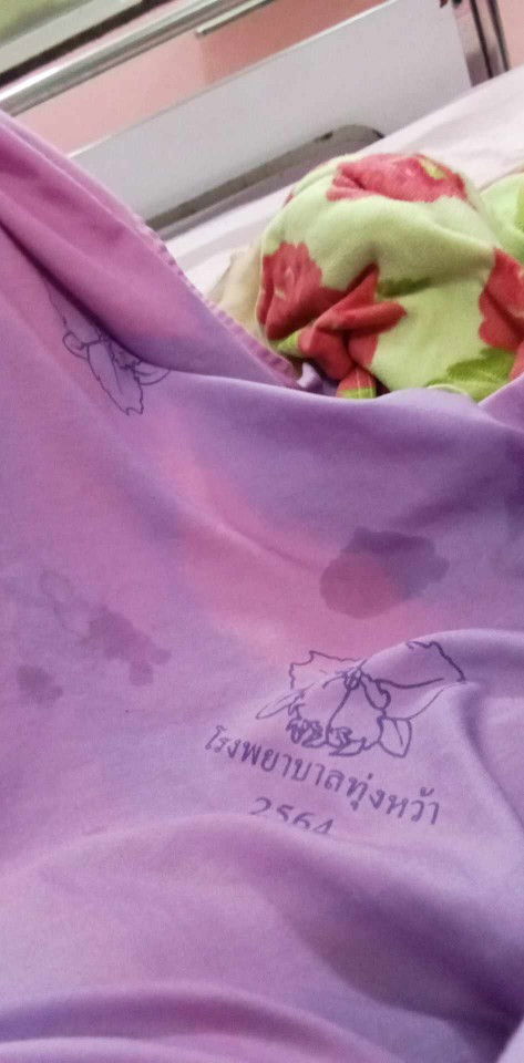 33+2สัปดา ท้องแรกคลอดก่อนกำหนด